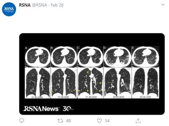 Çinli adamın röntgen fotoğrafları ortaya çıktı - Resim : 1