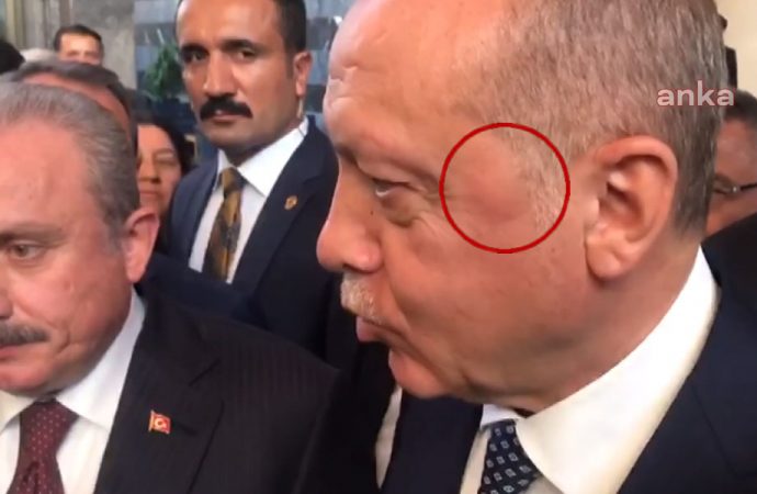Erdoğan'ın yüzündeki dikkat çeken ayrıntı ! - Resim : 1