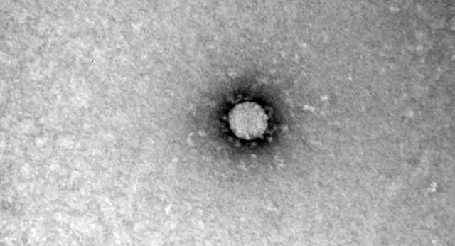Koronavirüsün mikroskop görüntülerini çekti - Resim : 1