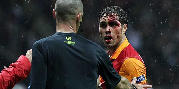 Elmander'in görüntüsü hayranlarını şok etti ! - Resim : 1