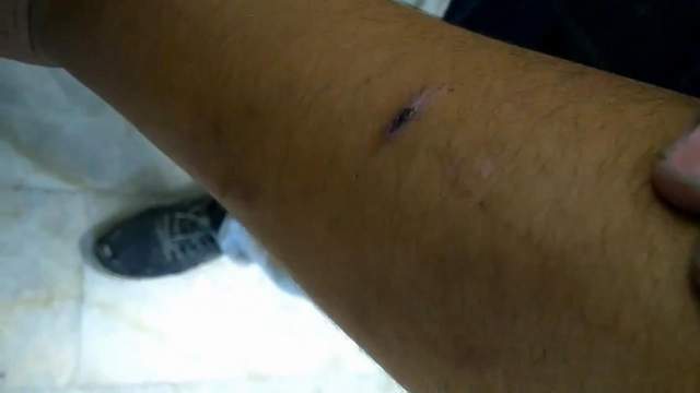 Beyin ameliyatı geçirmiş çocuğa dayak ve işkence iddiası - Resim : 1