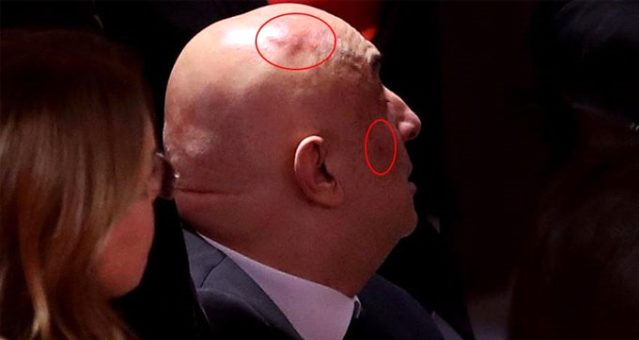 Meclis'teki kavga sonrası kafasında ve yüzünde şişlik oluştu ! - Resim : 2
