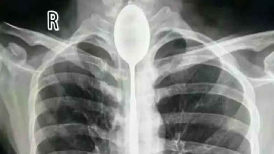 Doktorlar bile şoke oldu ! 1 yıl böyle yaşamış - Resim : 1